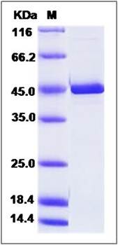 SDS-PAGE analysis of human CS protein (His Tag)