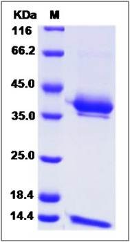SDS-PAGE analysis of Cynomolgus CD1E (His Tag) protein