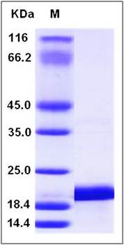 SDS-PAGE analysis of Human IL1F6 protein (His Tag)