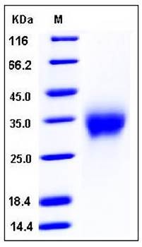 SDS-PAGE analysis of mouse ACVR2A His tag protein