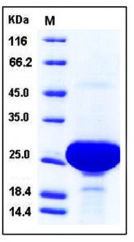 SDS-PAGE analysis of Human PARK7 His tag protein
