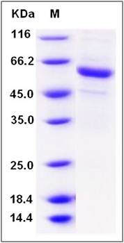 SDS-PAGE analysis of Human PSG6 protein (His Tag)