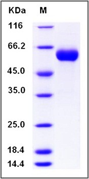 SDS-PAGE analysis of human SerpinC1 His tag protein