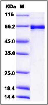 SDS-PAGE analysis of human EphB2 protein (GST Tag)