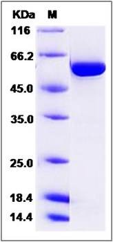 SDS-PAGE analysis of human TGFBR1 protein (GST Tag)