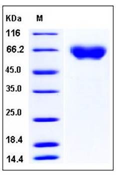 SDS-PAGE analysis of human AXL His tag protein
