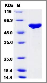SDS-PAGE analysis of H7N9 NP protein (His Tag)