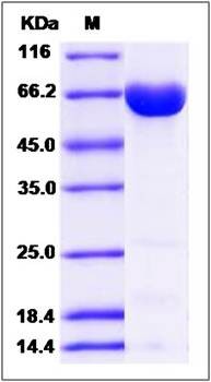 SDS-PAGE analysis of human ALOX15B protein
