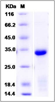 SDS-PAGE analysis of human EBAG9 protein (His Tag)