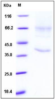 SDS-PAGE analysis of human GPC3 His tag protein