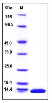 SDS-PAGE analysis of human SH2D1A His tag protein