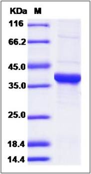 SDS-PAGE analysis of mouse GAPDH protein (His Tag)
