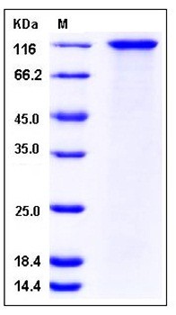 SDS-PAGE analysis of human SORCS1 His tag protein