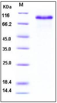 SDS-PAGE analysis of human GRN His tag protein
