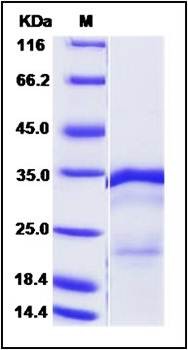 SDS-PAGE analysis of H1N1 M1 protein (His Tag)