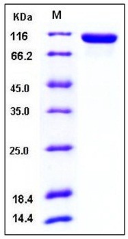 SDS-PAGE analysis of human Tie2 His tag protein