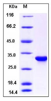 SDS-PAGE analysis of human CYB5R1 protein (His Tag)