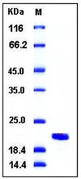 SDS-PAGE analysis of Human NME1 His tag protein