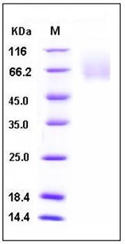 SDS-PAGE analysis of human CEACAM1 His tag protein