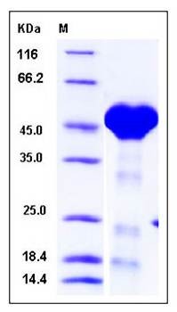 SDS-PAGE analysis of Human PPM1A protein (His Tag)