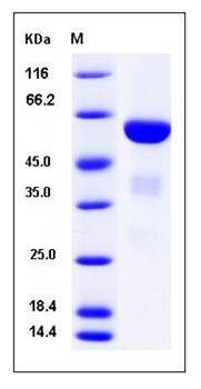 SDS-PAGE analysis of mouse ApoAI protein