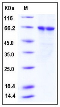 SDS-PAGE analysis of Human PLK1 His tag protein