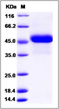 SDS-PAGE analysis of Human RCN3 protein (His Tag)