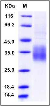 SDS-PAGE analysis of Human KLRC1 protein (His Tag)