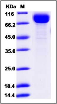 SDS-PAGE analysis of Cynomolgus IL18R1 protein