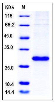 SDS-PAGE analysis of Human RHOA His tag protein