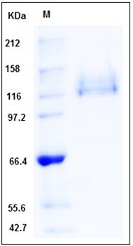 SDS-PAGE analysis of Human ITGA6 flag His tag protein