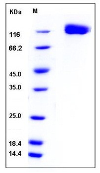 SDS-PAGE analysis of Mouse OSMR His tag protein