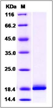 SDS-PAGE analysis of Human VSNL1 protein (Native)