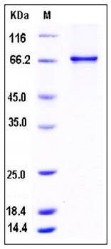 SDS-PAGE analysis of human CSNK1G1 His GST tag protein