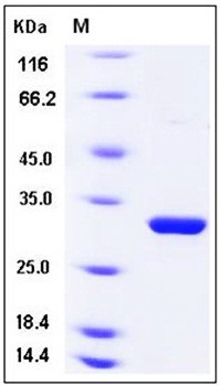 SDS-PAGE analysis of Human LMAN2 His tag protein