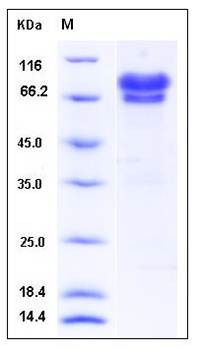 SDS-PAGE analysis of Human NGFR protein