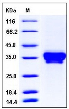 SDS-PAGE analysis of human STIM1 His tag protein