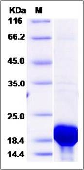 SDS-PAGE analysis of Human PFDN2 protein (His Tag)
