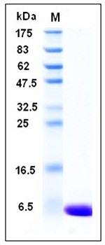 SDS-PAGE analysis of Human S100A1 protein