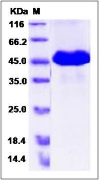 SDS-PAGE analysis of Human PNLIPRP1 protein (His Tag)