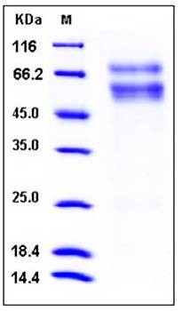 SDS-PAGE analysis of mouse CHST3 His tag protein