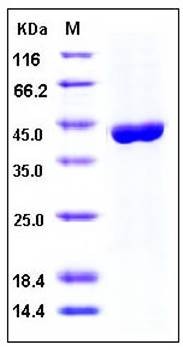 SDS-PAGE analysis of human ACY1 His tag protein