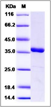 SDS-PAGE analysis of Human MKK6 protein
