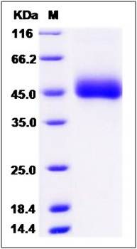 SDS-PAGE analysis of human DPEP2 protein (His Tag)