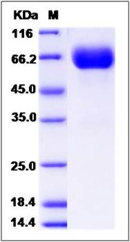 SDS-PAGE analysis of rat GHR protein