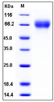 SDS-PAGE analysis of human SerpinF2 His tag protein