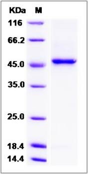 SDS-PAGE analysis of human B3GNT6 protein (His Tag)