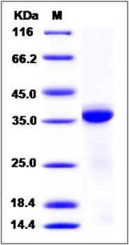 SDS-PAGE analysis of human CTSL1 His tag protein