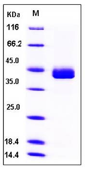 SDS-PAGE analysis of Human CD23 His tag protein