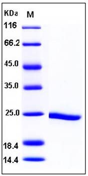 SDS-PAGE analysis of Human HSP90AB1 protein